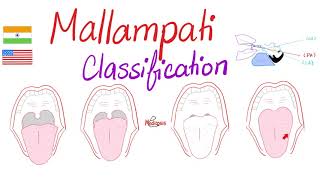 Mallampati Score Classification for Airway Management [upl. by Olocin]