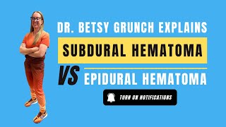 Epidural vs subdural hematoma neurosurgery emergency subduralhematoma epiduralhematoma [upl. by Nosiram]