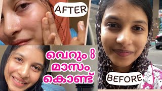 💯😳quotഎങ്ങനെ ഇത്ര glow ആയി quot My skin care products  Selmadinash [upl. by Brazee891]