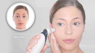 HoMedics Radiance Microdermabrasion  How to use [upl. by Leunamnauj906]