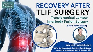 Recovery after TLIF Surgery  Life after Spinal Fusion Surgery  Spinal Surgery Specialist in India [upl. by Clayborn]