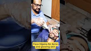 Health benefits of hijama healing youtube doctor face viral [upl. by Azilem]