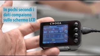 Come si usa CNOGA MTX  by Artech srl  febbraio 2018 [upl. by Ryder]