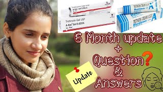 Tretinoin cream 005 results after 2 year and answers of all your questions  best anti aging [upl. by Meisel]