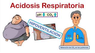 INTERPRETACIÓN DE LA GASOMETRÍA EN 4 PASOS 💉💉 con EJERCICIOS de PRÁCTICA al final del video [upl. by Eimak]