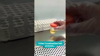 Urine exam fluid process [upl. by Iilek678]