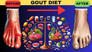 Optimal Nutrition for Gout Relief Top Foods to Include in Your Gout Diet [upl. by Bloom462]