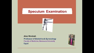 Speculum Examination [upl. by Belamy]