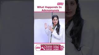 Adenomyosis What are the Symptoms Treatment and Diagnosis  shorts pregnancytips pregnancy [upl. by Elana]