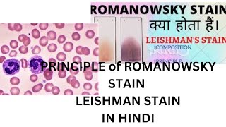 Romanowsky stain in hindi । Leishman stain । haematology । dmlt । principleof romanowsky stain [upl. by Tlevesor]