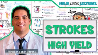 Ischemic and Hemorrhagic Strokes  High Yield [upl. by Miza]