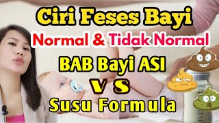 Ciri feses bayi normal vs tidak normal dan feses bayi ASI dan susu formula [upl. by Pandolfi486]