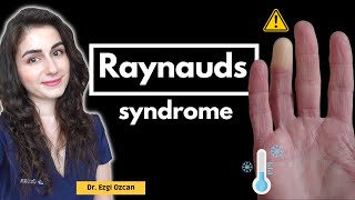 Raynauds Syndrome Causes Symptoms and Effective Management [upl. by Johiah]