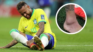 Top 6 Worst Injuries In Sports [upl. by Enecnarf]