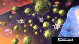 Acute Lymphocytic Leukemia ALL Animation [upl. by Amein]