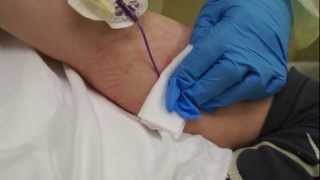 AmputeeOT PICC line removal [upl. by Johns]