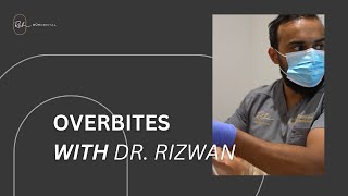 Why You Should Fix An Overbite With Dr Rizwan [upl. by Llebyram]