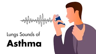 Sounds of Asthma  Wheezing Lung Sounds [upl. by Alberic]