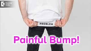 Painful bump on buttocks Causes Symptoms amp Treatment  Dr Rajdeep Mysore  Doctors Circle [upl. by Yednil]