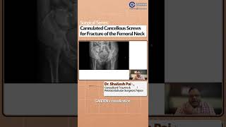 Cannulated Cancellous Screws for Femoral Neck Fractures  Dr Shailesh Pai  Surgical Series [upl. by Idnahk905]