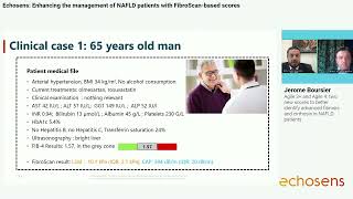 FibroScan®based Scores in NAFLD patient management [upl. by Lyrak]