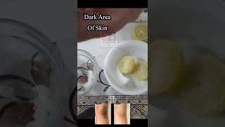 How to lighten dark skin on body  Treatment options for dark skin on body  skincare darkskin [upl. by Teddman]