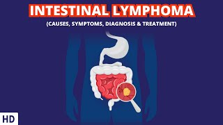 The Silent Killer Understanding Intestinal LymphomaIntestinal Lymphoma [upl. by Nonnelg]