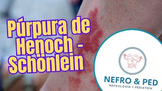 Púrpura de Henoch  Schönlein  Vasculitis por IgA  purpuradehenoch vaculitisleucocitoclastica [upl. by Saidel795]