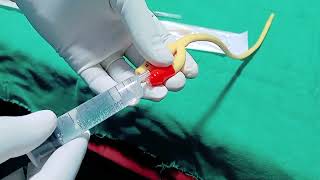 Male and female Catheter insertion Procedure in Hindi  insertion trick  फोलीज केसे लगाया जाता है। [upl. by Gothurd]