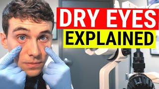 What Causes Dry Eyes Eye Doctor Explains Dry Eye Syndrome [upl. by Essinger687]