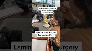 Laminectomy Surgery Explanation with Model doctor healthcare learning [upl. by Afatsum]