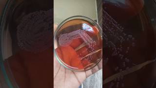 Bacterial colonies  culture media  bacterial growth on agar plates  how to grow bacteria biology [upl. by Heall]