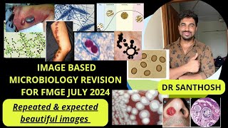 IMAGE BASED REVISION FMGE JULY 2024 MICROBIOLOGY  NEET PG 2024 [upl. by Aneertak]