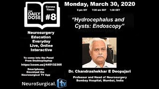 Hydrocephalus and Cysts Endoscopy [upl. by Nac]