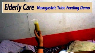 Elderly Care Nasogastric Tube Feeding For Stroke Patient at Home [upl. by Aivila]