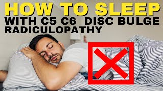 Ep19 How To Sleep With C5 C6 Disc Bulge Radiculopathy  Dr Walter Salubro Chiropractor in Vaughan [upl. by Annaet]