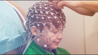 High Density HD EEG Testing Services [upl. by Suitangi]