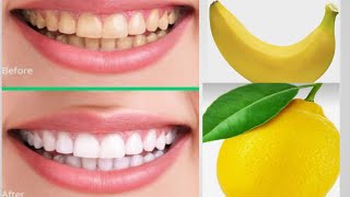 I Tried Banana Peel and Lemon Teeth Whitening it actually worked beautywithkal [upl. by Fleisher]