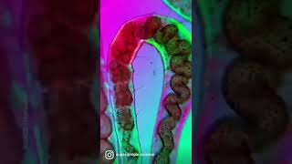 Worm displaying peristaltic movements I Peristalsis [upl. by Leiva750]