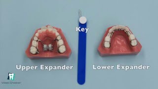 How to Turn an Expander [upl. by Einaoj]