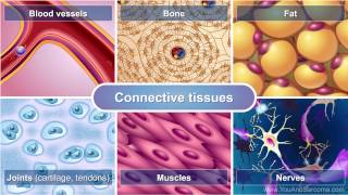 Understanding Soft Tissue Sarcoma [upl. by Beckett]