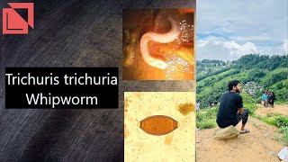 parasitology Trichuris trichura Whipworm norcet microbiology labtechnician mltlab [upl. by Amalie]