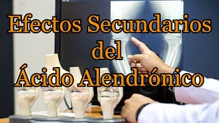 Efectos Secundarios del Ácido Alendrónico [upl. by Yajeet]