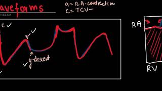 Jugular Venous PressureJVP waveform Simplified totally Hindi Language [upl. by Rehttam]