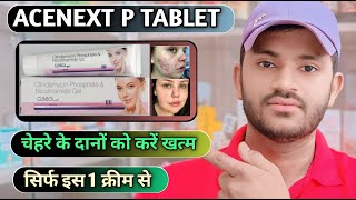 Clinsol gel uses dose benefits and Side effects full review in hindi [upl. by Bala]