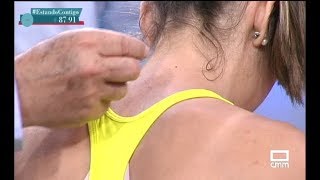 Acupuntura dolor de cuello  Estando Contigo  CMM [upl. by Alyakem]