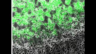 GFP vaccinia virus plaque formation [upl. by Aratnahs]