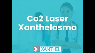 Co2 Laser Xanthelasma  Whats the pros and cons of Co2 Laser Xanthelasma Treatment   By XANTHEL ® [upl. by Nahij]