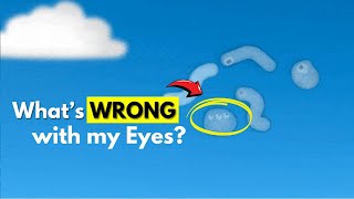 What are those floating things in your eyes  Eye Floaters Explained [upl. by Ernaline607]