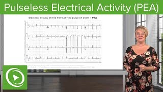 Pulseless Electrical Activity PEA – Emergency Medicine  Lecturio [upl. by Val]